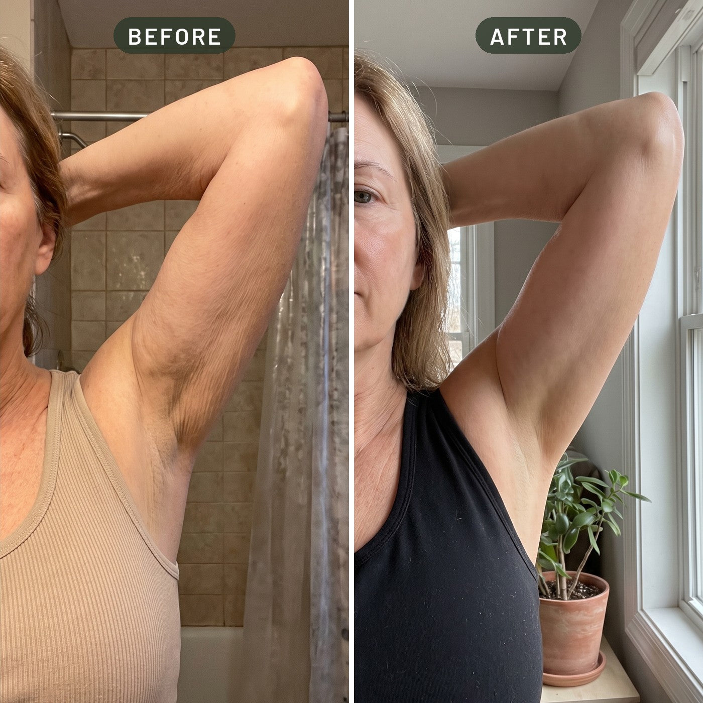 Upper arm before and after four weeks of daily use