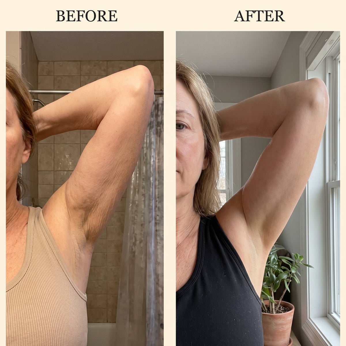 Upper arm before and after four weeks of daily use