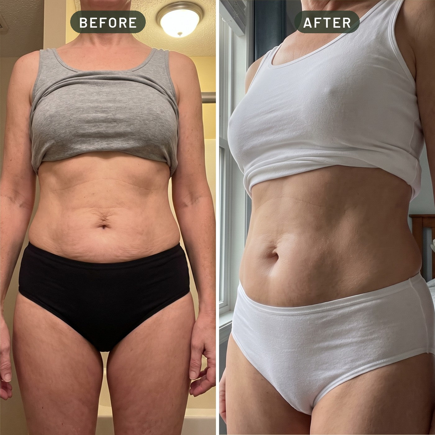 Lower tummy before and after four weeks of daily use