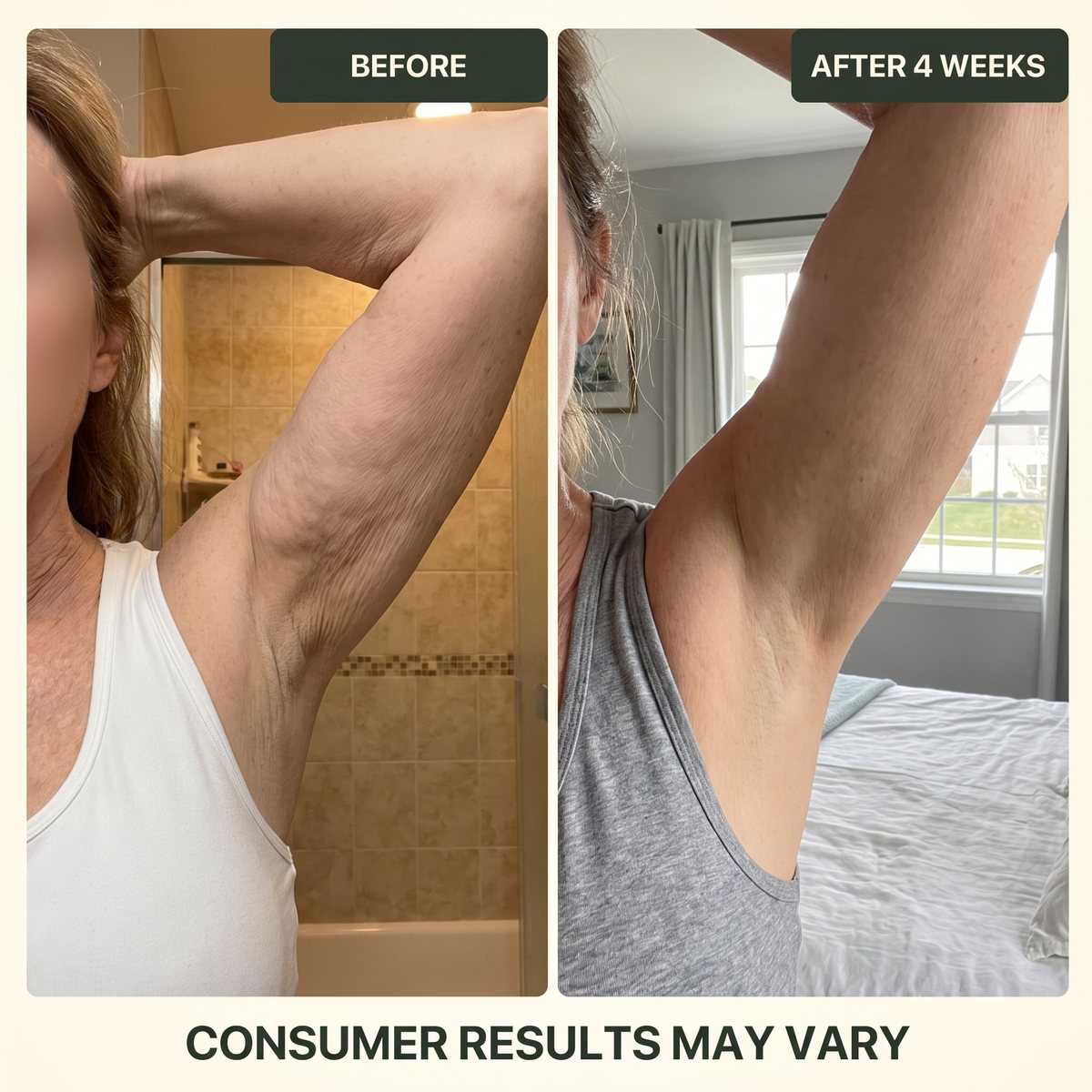 Upper arm before and after four weeks of daily use